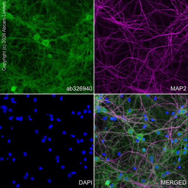 Immunocytochemistry/ Immunofluorescence - Anti-MAP2 antibody [HM-2] - Neuronal Marker (AB11267)