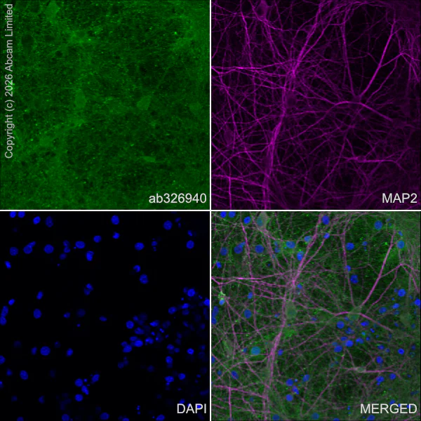Immunocytochemistry/ Immunofluorescence - Anti-MAP2 antibody [HM-2] - Neuronal Marker (AB11267)