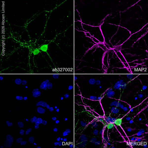 Immunocytochemistry/ Immunofluorescence - Anti-MAP2 antibody [HM-2] - Neuronal Marker (AB11267)