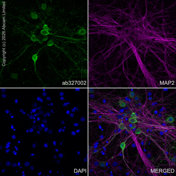 Immunocytochemistry/ Immunofluorescence - Anti-MAP2 antibody [HM-2] - Neuronal Marker (AB11267)