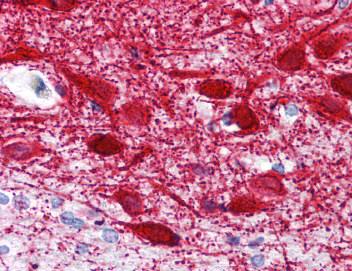 Immunohistochemistry (Formalin/PFA-fixed paraffin-embedded sections) - Anti-MAP2 antibody [MT-08] (AB118898), expandable thumbnail