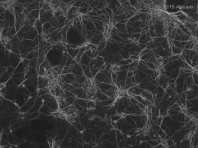 Immunocytochemistry/ Immunofluorescence - Anti-MAP2 antibody - Neuronal Marker (AB32454)