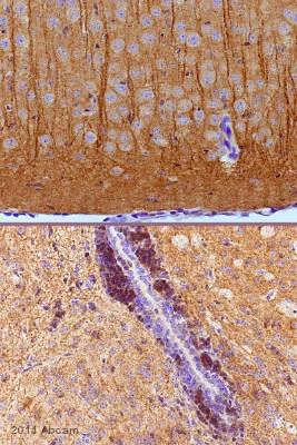 Immunohistochemistry (Formalin/PFA-fixed paraffin-embedded sections) - Anti-MAP2 antibody - Neuronal Marker (AB32454)