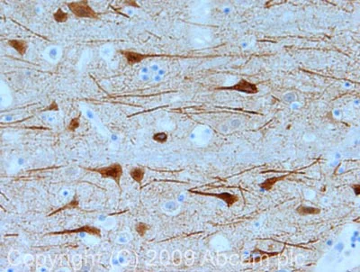 Immunohistochemistry (Formalin/PFA-fixed paraffin-embedded sections) - Anti-MAP2 antibody - Neuronal Marker (AB32454)