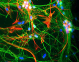 Immunocytochemistry - Anti-MAP2 antibody - Neuronal Marker (AB5392), expandable thumbnail