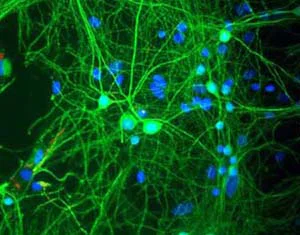 Immunocytochemistry - Anti-MAP2 antibody - Neuronal Marker (AB5392)