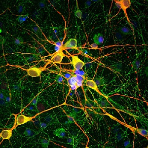 Immunocytochemistry/ Immunofluorescence - Anti-MAP2 antibody - Neuronal Marker (AB5392), expandable thumbnail