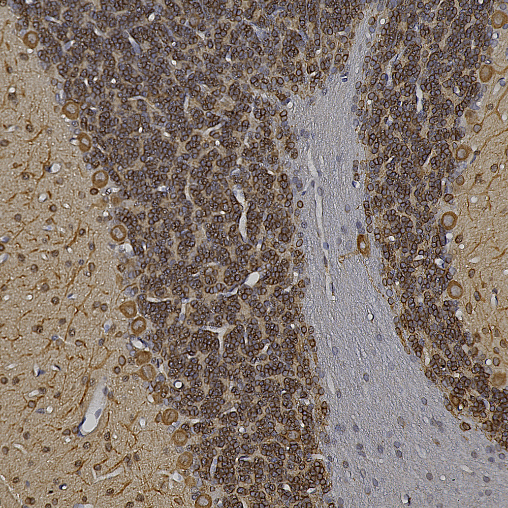 Immunohistochemistry (Formalin/PFA-fixed paraffin-embedded sections) - Anti-MAP2 antibody - Neuronal Marker (ab5392), expandable thumbnail