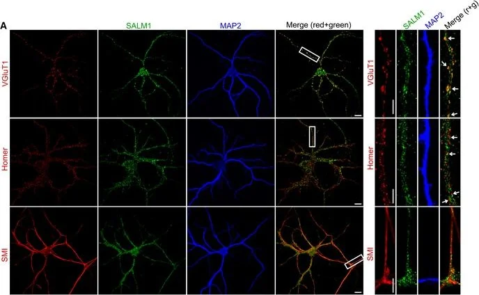 Immunocytochemistry/ Immunofluorescence - Anti-MAP2 antibody - Neuronal Marker (AB75713)