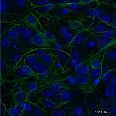 Immunocytochemistry - Anti-MAP2 antibody (AB92434), expandable thumbnail