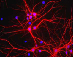 Immunocytochemistry - Anti-MAP2 antibody - Neuronal Marker (AB92434), expandable thumbnail