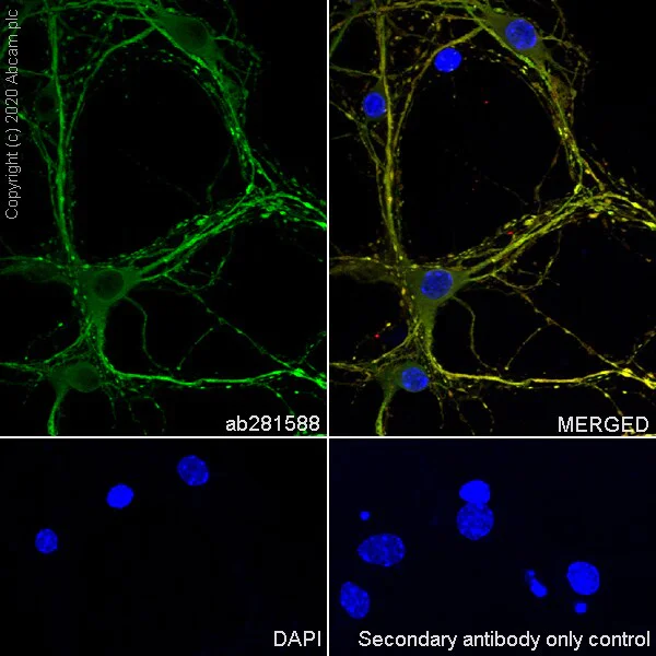 Immunocytochemistry/ Immunofluorescence - Anti-MAP2 antibody [RM1010] - BSA and Azide free (AB283865)