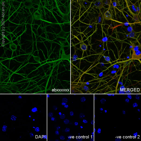 Immunocytochemistry/ Immunofluorescence - Anti-MAP2 antibody [RM1037] - BSA and Azide free (AB288577)