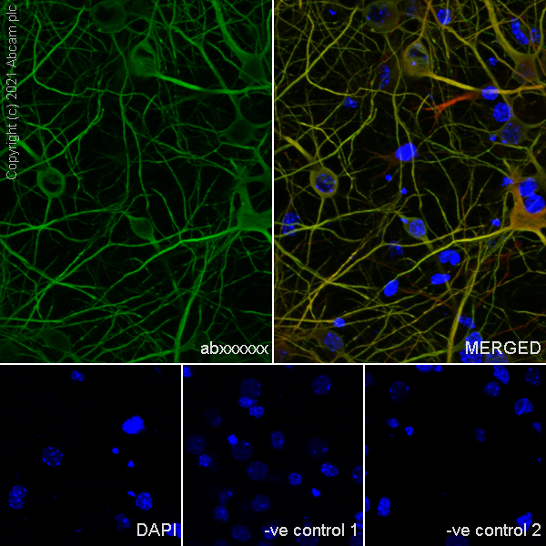 Immunocytochemistry/ Immunofluorescence - Anti-MAP2 antibody [RM1037] (ab288714), expandable thumbnail