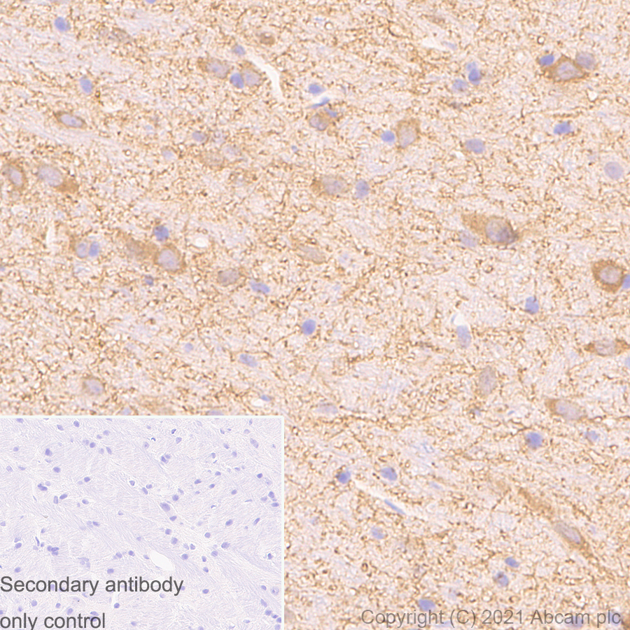 Immunohistochemistry (Formalin/PFA-fixed paraffin-embedded sections) - Anti-MAP2 antibody [RM1037] (AB288714), expandable thumbnail