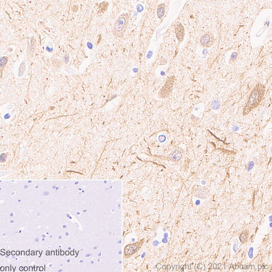 Immunohistochemistry (Formalin/PFA-fixed paraffin-embedded sections) - Anti-MAP2 antibody [RM1037] (AB288714), expandable thumbnail