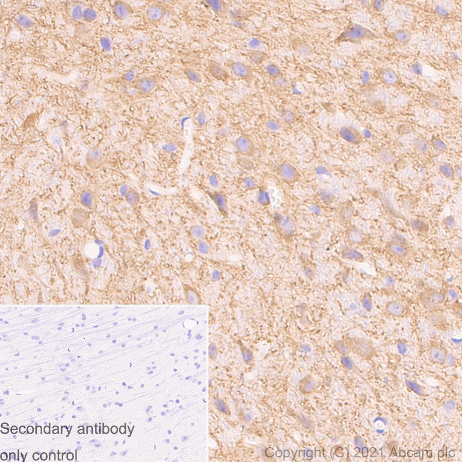Immunohistochemistry (Formalin/PFA-fixed paraffin-embedded sections) - Anti-MAP2 antibody [RM1037] (AB288714), expandable thumbnail