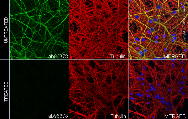 Immunocytochemistry/ Immunofluorescence - Anti-MAP2 (phospho S136) antibody [EPR2361] - BSA and Azide free (AB247601), expandable thumbnail
