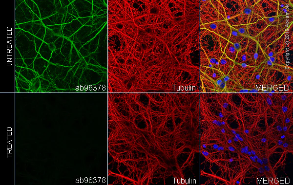 Immunocytochemistry/ Immunofluorescence - Anti-MAP2 (phospho S136) antibody [EPR2361] - BSA and Azide free (AB247601)