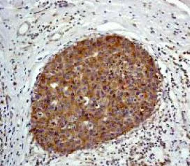 Immunohistochemistry (Formalin/PFA-fixed paraffin-embedded sections) - Anti-MAP2K1IP1 antibody [Y130] (AB32134)