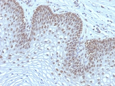 Immunohistochemistry (Formalin/PFA-fixed paraffin-embedded sections) - Anti-MAP3K1 antibody [2F6] (AB233925)