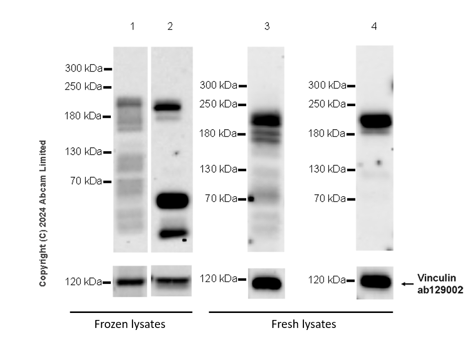 Western blot - Anti-MAP3K1 antibody [EPR26099-13] (AB322196), expandable thumbnail