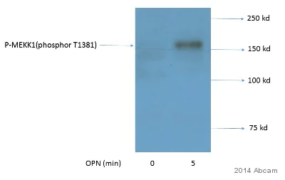Western blot - Anti-MAP3K1 (phospho T1400) antibody (AB138662)