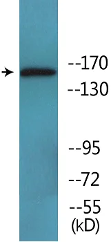 Western blot - Anti-MAP3K1 (phospho T1400) antibody (AB138662)