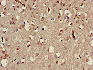 Immunohistochemistry (Formalin/PFA-fixed paraffin-embedded sections) - Anti-MAP3K13 antibody (AB224628)