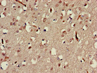 Immunohistochemistry (Formalin/PFA-fixed paraffin-embedded sections) - Anti-MAP3K13 antibody (AB224628)