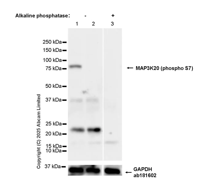 Western blot - Anti-MAP3K20 (phospho S7) antibody [EPR28256-30] (AB324636)
