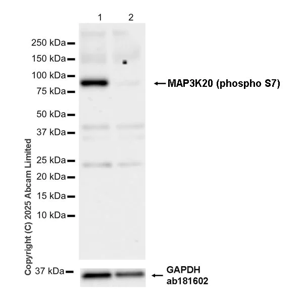 Western blot - Anti-MAP3K20 (phospho S7) antibody [EPR28256-30] (AB324636)