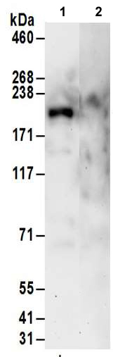 Immunoprecipitation - Anti-MAP3K4 antibody (AB186125), expandable thumbnail