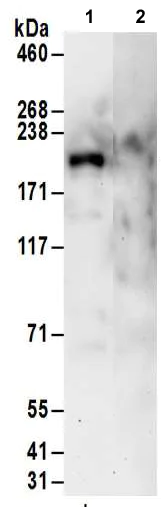 Immunoprecipitation - Anti-MAP3K4 antibody (AB186125)