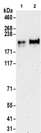 Western blot - Anti-MAP3K4 antibody (AB186125), expandable thumbnail