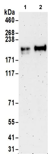 Western blot - Anti-MAP3K4 antibody (AB186125)