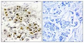 Immunohistochemistry (Formalin/PFA-fixed paraffin-embedded sections) - Anti-MAP3K6 antibody (AB111252)