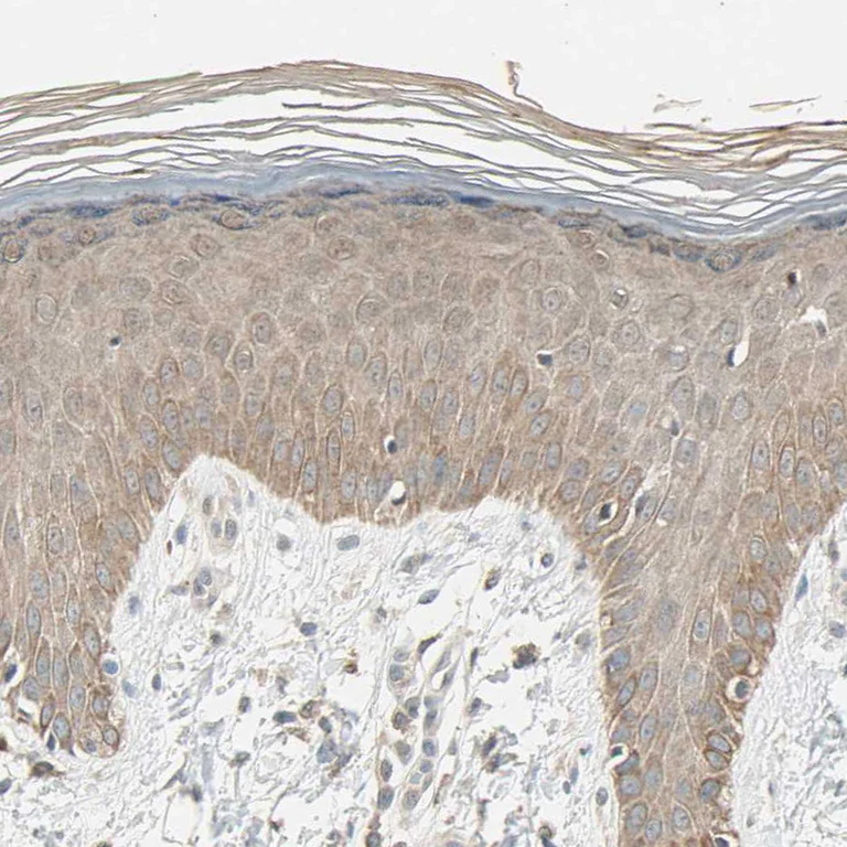 Immunohistochemistry (Formalin/PFA-fixed paraffin-embedded sections) - Anti-MAP3K7 Antibody (AB327188)