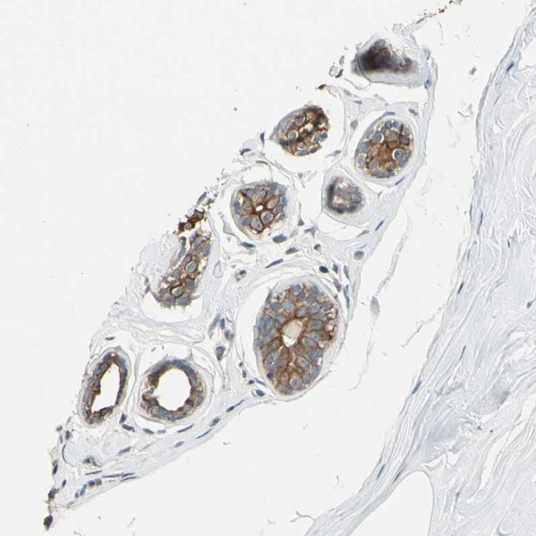 Immunohistochemistry (Formalin/PFA-fixed paraffin-embedded sections) - Anti-MAP3K7 Antibody (AB327188)