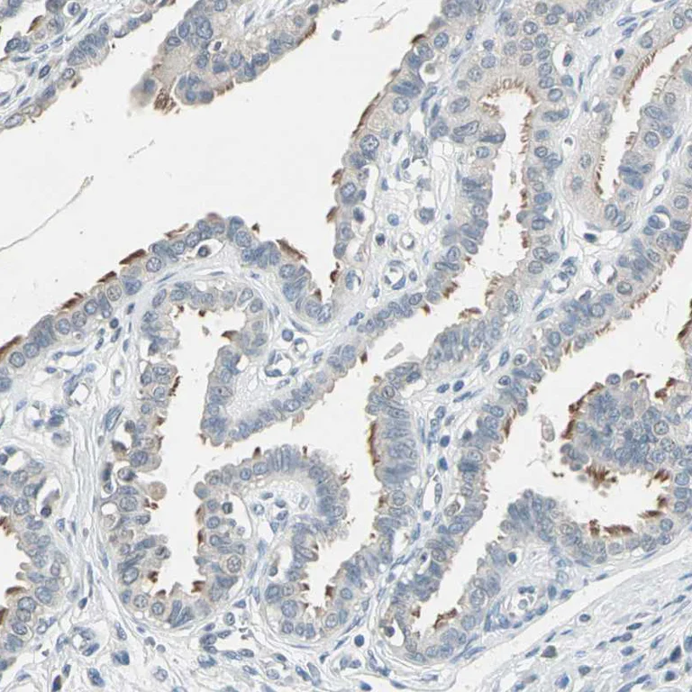 Immunohistochemistry (Formalin/PFA-fixed paraffin-embedded sections) - Anti-MAP3K7 Antibody (AB327188)