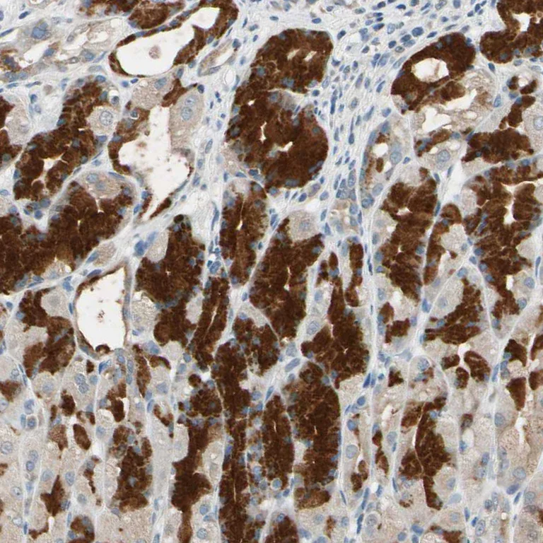 Immunohistochemistry (Formalin/PFA-fixed paraffin-embedded sections) - Anti-MAP3K7 Antibody (AB327188)