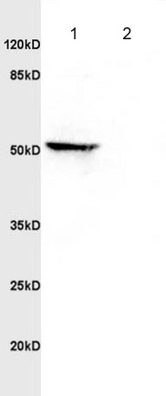 Western blot - Anti-MAP3K8/COT antibody (AB217684)