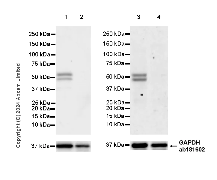 Western blot - Anti-MAP3K8/COT antibody [EPR26102-115] (AB321964)