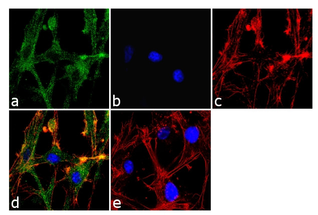 Immunocytochemistry/ Immunofluorescence - Anti-MAP3K8/COT antibody [RP23040075] (AB308011)