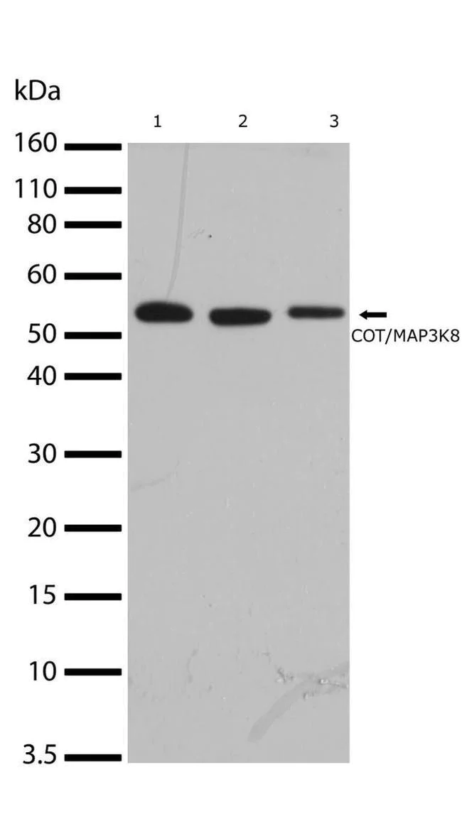 Western blot - Anti-MAP3K8/COT antibody [RP23040075] (AB308011)