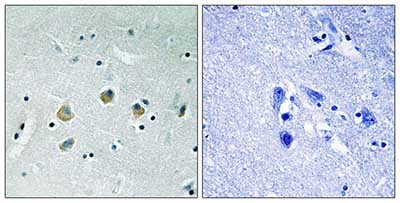Immunohistochemistry (Formalin/PFA-fixed paraffin-embedded sections) - Anti-MAP3K8/COT (phospho S400) antibody (AB192667), expandable thumbnail