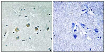 Immunohistochemistry (Formalin/PFA-fixed paraffin-embedded sections) - Anti-MAP3K8/COT (phospho S400) antibody (AB192667)