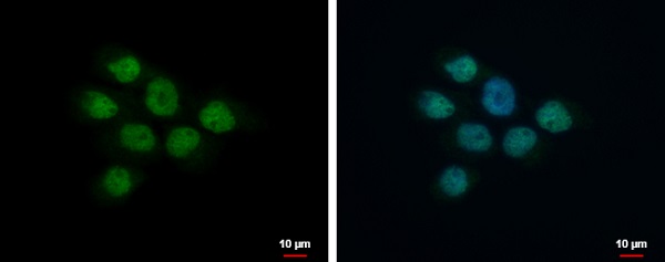 Immunocytochemistry/ Immunofluorescence - Anti-MAP3K9 antibody (AB228752), expandable thumbnail