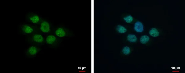 Immunocytochemistry/ Immunofluorescence - Anti-MAP3K9 antibody (AB228752)