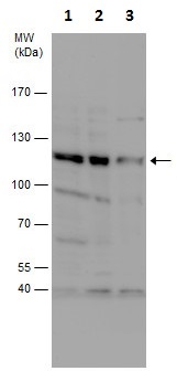 Western blot - Anti-MAP3K9 antibody (AB228752), expandable thumbnail